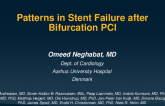TCT 667: Patterns in Stent Failure After Bifurcation PCI - An OCTOBER Trial Substudy