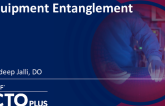 Equipment Entanglement