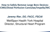 How to Safely Remove Large Bore Devices: ECMO/Distal Perfusion Cannulae/Impella/MCS