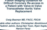 Fusion Imaging Guidance for Difficult Coronary Re-Access in a Patient With Valve-in-Valve Transcatheter Aortic Valve Replacement
