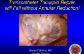 Adjunct or Standalone: Transcatheter Tricuspid Repair Will Fail Without Annular Reduction!