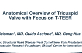 Anatomical Overview of Mitral vs. Tricuspid Valve with Focus on TEER