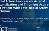 TCT 1390: Radial Artery Reaccess via Arterial Recanalization and Thrombus Aspiration in a Patient With Total Radial Artery Occlusion