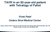 TCT 1579: TAVR in an 82-Year-Old Patient With Tetralogy of Fallot