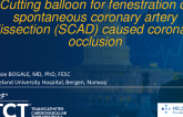 TCT 1192: Cutting Balloon for Fenestration of Spontaneous Coronary Artery Dissection (SCAD) Caused Coronary Occlusion