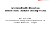 Subclinical Leaflet Thrombosis : Identification, Incidence and Importance