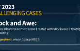 TCT 1002: Shock And Awe: Shockwave Intravascular Lithotripsy and Stenting of a Complex Calcified Infrarenal Aortic Stenosis in a Symptomatic Elderly Patient
