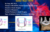 SAVR in Severe Aortic Stenosis With Small Aortic Annulus: What Are the Options?