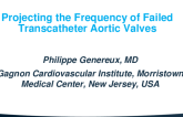 TCT 870: Prediction Models for the Treatment of Bioprosthetic Aortic Valve Failure in the United States