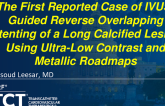 TCT 1160: The First Reported Case of IVUS-Guided Reverse Overlapping Stenting of a Long Calcified Lesion Using Ultra-Low Contrast and Metallic Roadmaps