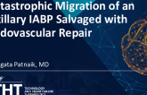 Catastrophic Migration of an Axillary IABP Salvaged With Endovascular Repair