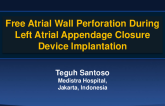 TCT 927: Free Atrial Wall Perforation During Left Atrial Appendage Closure Device Implantation