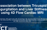TCT 84: Association Between Tricuspid Regurgitation and Liver Stiffness Using 4D Flow Cardiac MRI