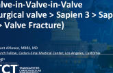 TCT 1501: Valve-in-Valve-in-Valve (Surgical Valve > Sapien 3 > Sapien 3 > Valve Fracture)