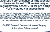 TCT 589: Diagnostic performance of intravascular ultrasound based FFR versus single angiography view based QFR for pre and post PCI physiological assessment