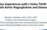 China Experiences with J-Valve TAVR for Both Aortic Regurgitation and Stenosis