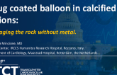 TCT 853: Drug-Coated Balloons in Calcified Lesions: Managing the Rock Without Metal