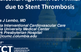 My Personal Algorithm for Primary PCI due to Stent Thrombosis
