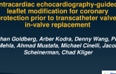 IntraCardiac Echocardiography-Guided Leaflet Modification for Coronary Protection Prior to Transcatheter Valve-in-Valve Replacement
