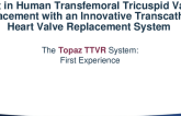 First in Human Transfemoral TTVR with an Innovative Valve Replacement System (Topaz)
