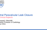 Step-by-step on How to Do Paravalvular Leak Closure: Tips and Tricks