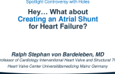 Position 2: Hey… What About Creating an Atrial Shunt for Heart Failure