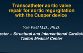 Transcatheter Aortic Valve Repair for Aortic Insufficiency Using the Cusper Device (Cuspa)