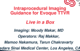 Live-in-a-Box TTVR Case with Emphasis on Intraprocedural Imaging