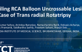 TCT 1305: Nailing RCA Balloon Uncrossable Lesion: A Case of Transradial Rotatripsy