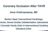 Managing Coronary Obstruction From TAVR