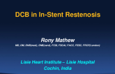 Case 1: DCB for In-Stent Restenosis