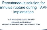 TCT 1137: Percutaneous Solution for Annulus Rupture During TAVR Implantation