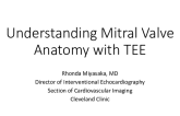 Understanding the Mitral Valve Anatomy With TEE