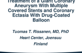 TCT 815: Treatment of a Giant Coronary Aneurysm With Multiple Covered Stents and Ectatic Coronary Artery Disease With Drug-Coated Balloon
