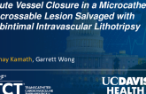 TCT 1376: Acute Vessel Closure in a Microcatheter-Uncrossable Lesion Salvaged With Subintimal Intravascular Lithotripsy