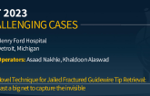 TCT 871: Novel Technique for Jailed Fractured Guidewire Tip Retrieval: Cast a big net to Capture the Invisible
