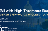 TCT 1533: STEMI With High Thrombus Burden: Deferred Stenting or Proceed to PCI