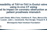 TCT 383: Feasibility of TAV-in-TAV in Evolut valves using in-vivo CT sizing and its impact on coronary obstruction and patient prosthesis mismatch