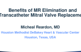 Benefits of MR Elimination & "Why TMVR"