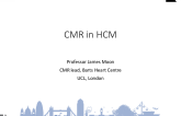 CMR in HCM