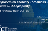 TCT 1502: Acute Stent Thrombosis in Elective Coronary CTO Angioplasty: IVUS for Rescue When OCT Fails