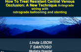 TCT 1232: How to Treat Resistant Central Venous Occlusion: Antegrade Wiring With Retrograde Wiring With Retrograde Ballooning and Stenting