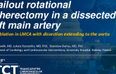TCT 1276: Bailout Rotational Atherectomy in the Left Main Dissection Extending to the Aorta