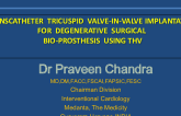 Transcatheter Tricuspid Valve-in-Valve Implantation for Degenerative Surgical Bio-Prosthesis THV