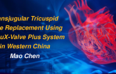 Transjugular Tricuspid Valve Replacement Using the LUX Valve in Western China
