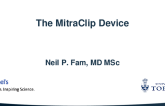 The MitraClip Device