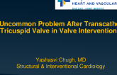 An Uncommon Problem After Tricuspid Valve in Valve