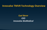 TWIST TMVR technology overview