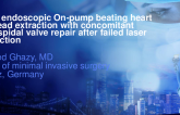 Total Endoscopic On-Pump Beating Heart PM-Lead Extraction With Concomitant Tricuspidal Valve Repair After Failed Laser Extraction