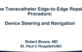 The Transcatheter Edge-to-Edge Repair Procedure: Device Steering and Navigation